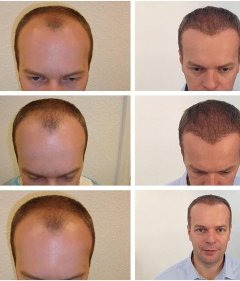 Untitled design - 2025-08-01T211956.606