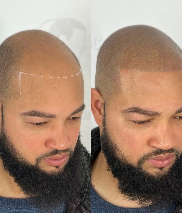 Untitled design - 2025-08-01T213319.090